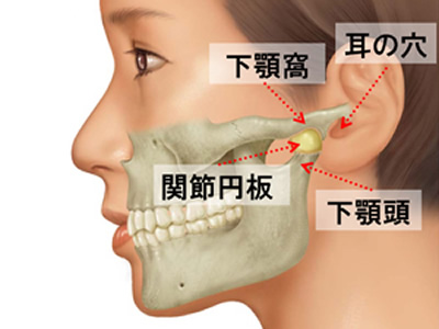 顎関節症の治療 | 桜川市で痛みに配慮したインプラント・歯医者なら山王歯科