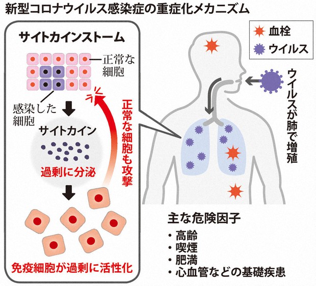 歯周病治療で新型コロナ感染予防を | 桜川市で痛みに配慮したインプラント・歯医者なら山王歯科